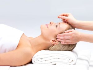 acupuntura para el dolor de cabeza