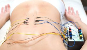 electroacupuntura para la lumbalgia y las ciática