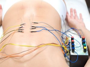 electroacupuntura Acupuntura y Osteopatía Madrid