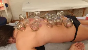 Curso de Ventosas Medicina Tradicional China Terapias Alternativas